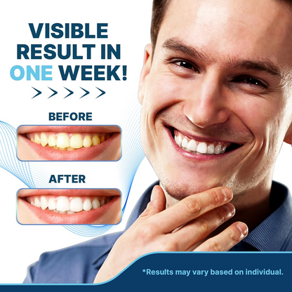 IvorySmile Natural Teeth Whitening Strips